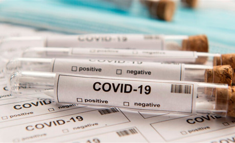 COVID-19 на Гадяччині: ситуація станом на 16 березня