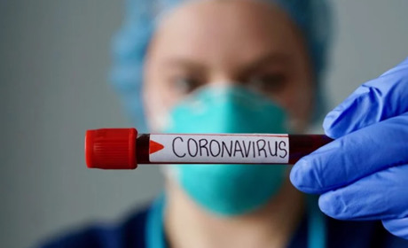 +18 нових випадків COVID-19 у Мелітополі. Пандемія і не думає відступати?