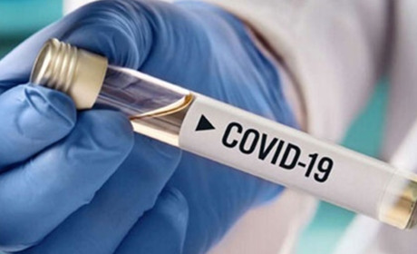 Третя хвиля COVID-19: за тиждень кількість хворих на Золотоніщині зросла більш як удвічі