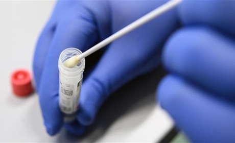 Лабораторно підтверджено 74 нових випадки COVID-19 в області