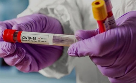 На Чортківщині за минулу добу - 214 нових випадків COVID-19 та дві смерті