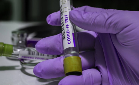 COVID-19 на Гадяччині: ситуація станом на 21 березня