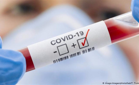 У Мелітополі ще 32 нових випадки захворювання на COVID-19