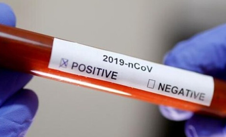 COVID-19 на Гадяччині: ситуація станом на 26 березня