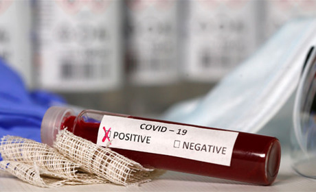 Кількість хворих на коронавірус на Гадяччині: дані станом на 28 березня