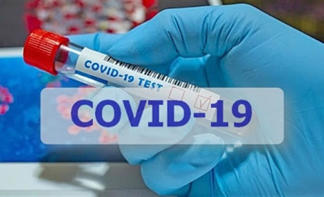 СOVID-19 наступає: у Старокостянтинові за добу хворобу підтвердили у 23 людей, у районі - в 17-ти