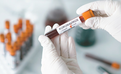 Від ускладнень COVID-19 за минулу добу на Гадяччині померло 2 людей