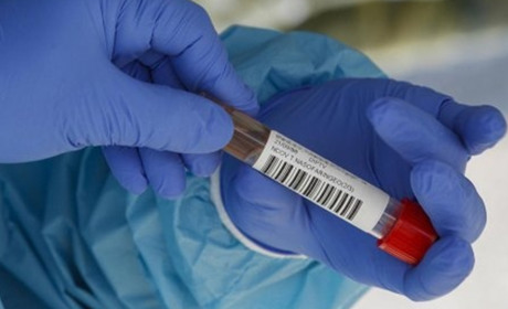 Кількість хворих на коронавірус на Гадяччині: дані станом на 1 квітня