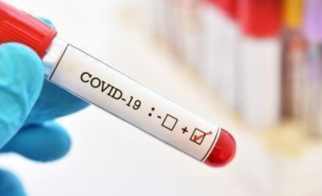 COVID-19 на Чортківщині: 65 нових випадків, 5 летальних