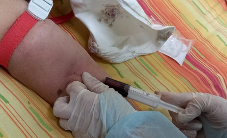 Перевірено на собі. Журналістка зі Сновська на Чернігівщині лікувалася від ковіду три місяці