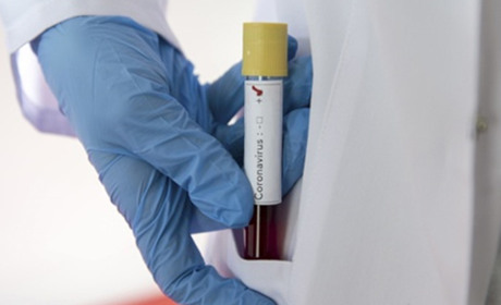 Кількість хворих на коронавірус на Гадяччині: дані станом на 10 квітня