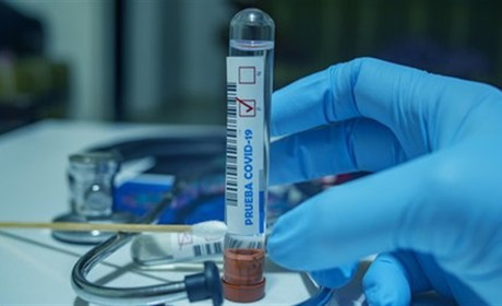 COVID-19 на Гадяччині: ситуація станом на 13 квітня