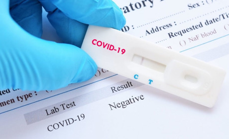 COVID-19 за добу підтвердили у 77 чортків'ян, один летальний випадок