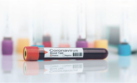 COVID-19 на Гадяччині: ситуація станом на 19 квітня