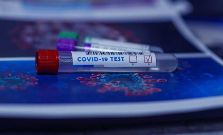 COVID-19 на Гадяччині: зареєстровано 48 нових випадків