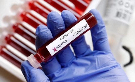 За добу в Луганській області виявили 52 хворих на COVID-19