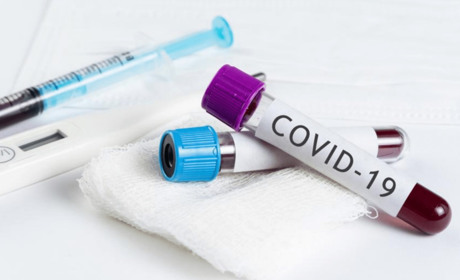 COVID-19 на Гадяччині: ситуація станом на 29 квітня