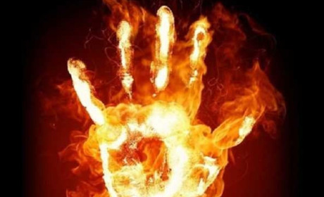 У Новограді сусіди врятували 27-річного хлопця від пожежі