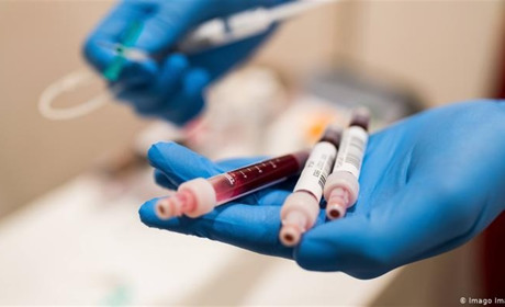 COVID-19 на Гадяччині: ситуація станом на 30 квітня