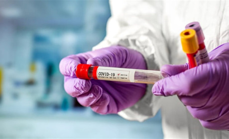 За добу в Луганській області виявили 236 хворих на COVID-19