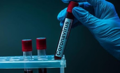 За добу в Луганській області виявили 157 хворих на COVID-19