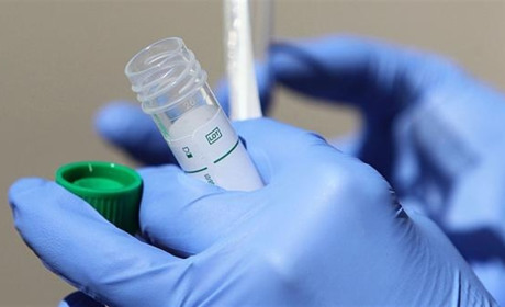 COVID-19 на Гадяччині: ситуація станом на 4 травня