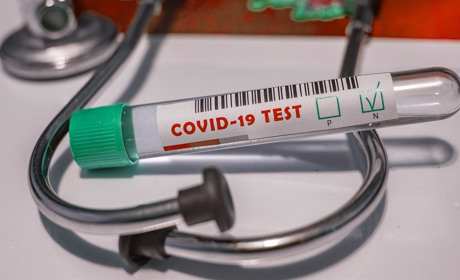 За минулу добу на COVID-19 захворіли всього 9 містян