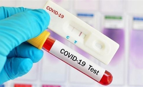 За добу на Чортківщині підтвердили 77 нових випадків COVID-19