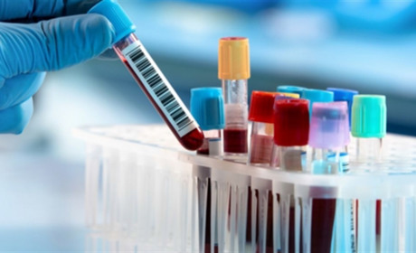 За добу в Луганській області виявили 264 хворих на COVID-19