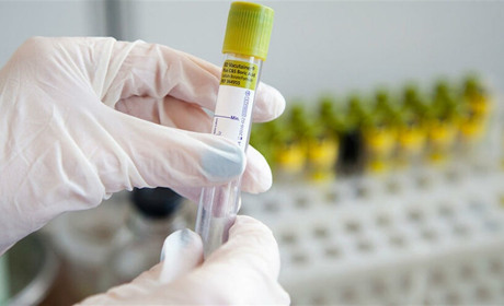 COVID-19 на Гадяччині: ситуація станом на 10 травня