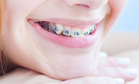 Особливості приватного ортодонта