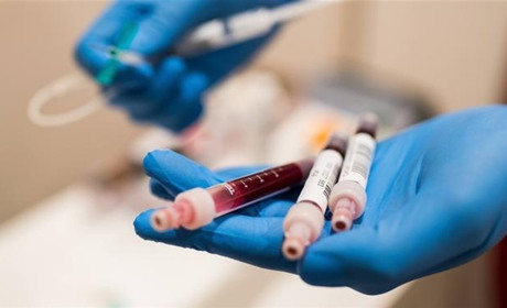 COVID-19 на Гадяччині: за добу більше людей одужали ніж захворіли