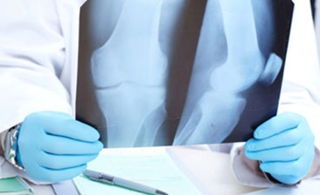 Гадяцький лікар-травматолог розповів про тонкощі професії до Всесвітнього дня травматолога