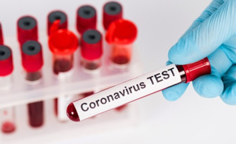 COVID-19 на Гадяччині: дані на 20 травня