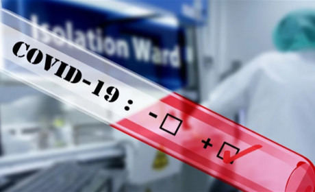 За добу в Луганській області виявили 123 хворих на COVID-19