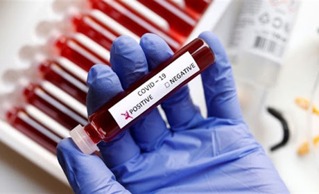 COVID-19 на Гадяччині: дані на 21 травня