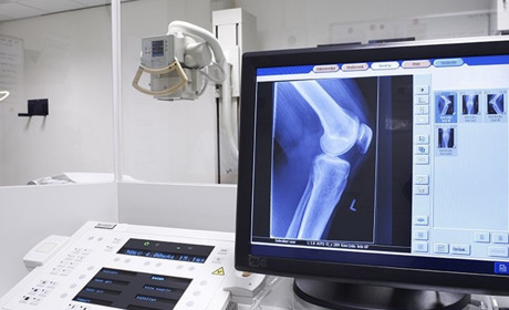 У Корюківській лікарні більше не використовуватимуть флюорограф