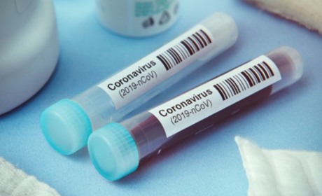 COVID-19 на Гадяччині: дані на 26 травня