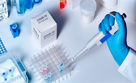 На COVID-19 хворіє 35 жителів Кагарличчини