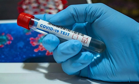 Від початку пандемії на COVID-19 в Україні захворіло понад 2 млн людей, померло - 50 тисяч