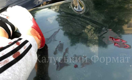 У Калуші собака напав на молодь