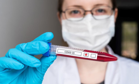 На COVID-19 хворіє 11 жителів Кагарличчини