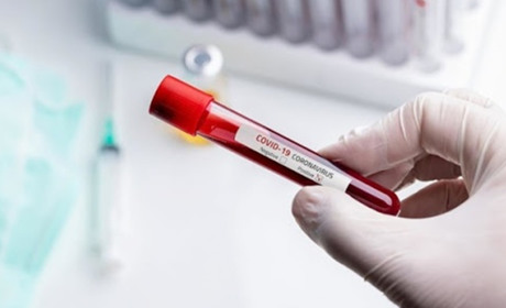 Коронавірус на Гадяччині: ситуація станом на 20 червня