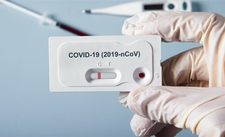 На COVID-19 хворіє 9 жителів Кагарличчини