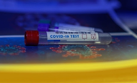 Коронавірус на Гадяччині: ситуація станом на 1 липня