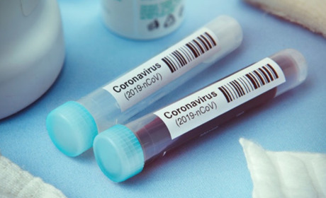 На Чортківщині виявили 2 нових випадки COVID-19