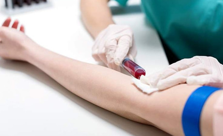 Чи є сенс робити тести на антитіла до COVID-19 до та після щеплення. Пояснення МОЗ