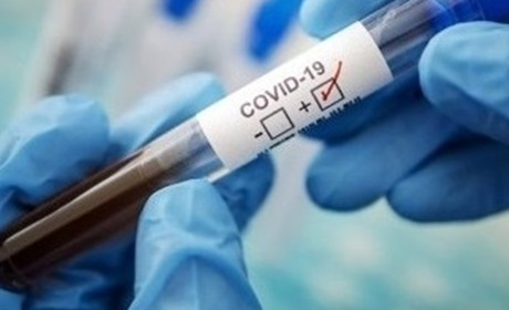 За попередню добу на Чортківщині зафіксовано 1 новий випадок COVID-19