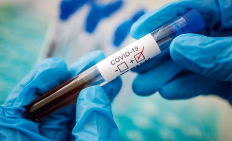 Ржищівщина: на COVID-19 хворіє 5 жителів громади