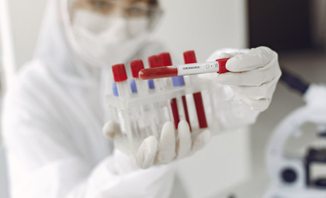 Кагарличчина: на COVID-19 хворіє 18 жителів громади